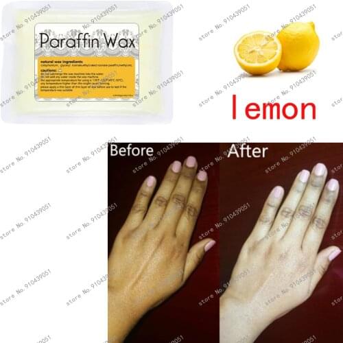 F'eDoren Paraffin Baths