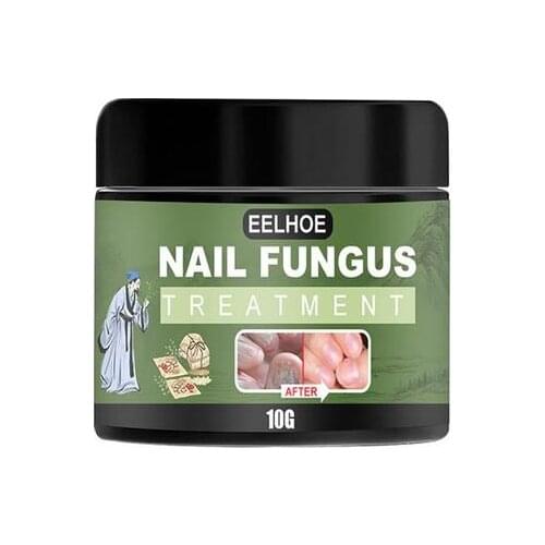 10g/20g/30g Nail Fungus Removal Cream Onychomycosis Fungal Nail Treatment Paronychia Anti Infection Feet Toe Fungal Nail Care