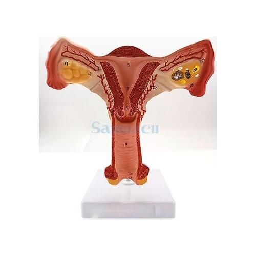 Uterus and Ovary Anatomical Model Human Female Medical Anatomy Internal Genital Organ