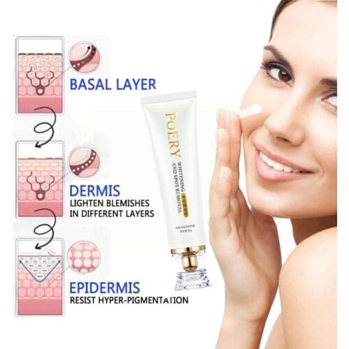 Effective Whitening Freckle Cream Remove Melasma Acne Melanin Spot Spots Dark Pigment Skin Cream Care Pigmentation Moisturi C7I5