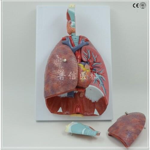 Free shipping&Respiration system model. Model. The respiratory tract. The model of the lung,Medical teaching