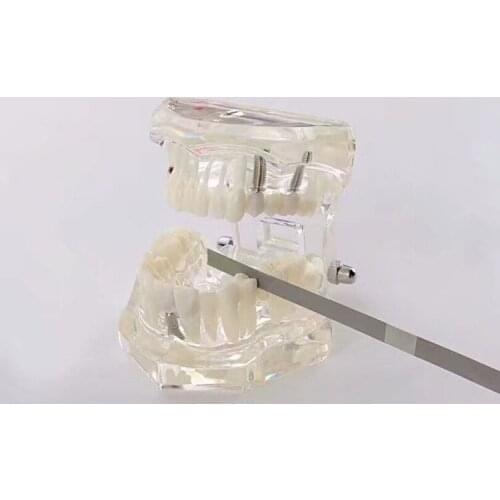 10pcs/set Dental refine 35-40um & polished 20-30um Orthodontic IPR Diamond Strips 2.5MM,4 MM, 6MM Med Grit (Single Side)