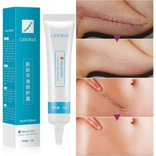 20g Natural Herbal Extract Scar Cream Stretch Marks Remover Skin Repair Facial Acne Spots Treatment Whitening Ointment Oct.29