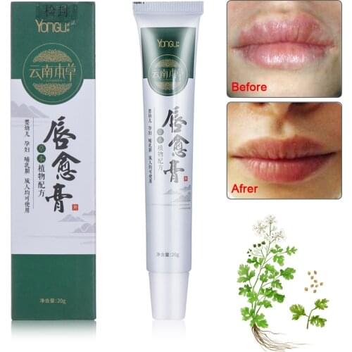 Chinese Natural Herbal Lip Cream Cold Sores Treatment Lip Repair Anti Lip Wrinkles Chapped Moisturizing Lip Oil Balm Lips Care