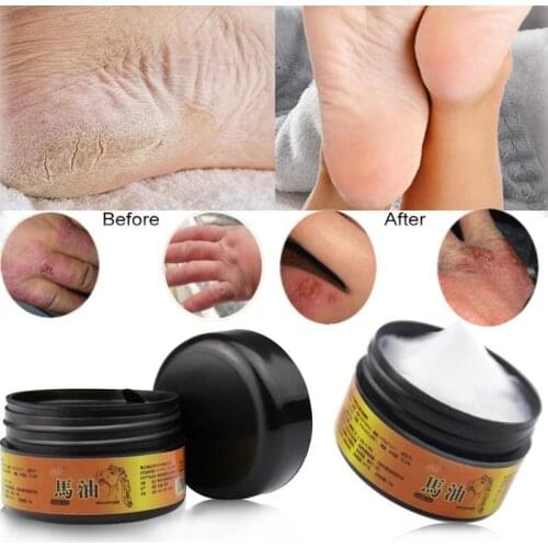 Slimming Patch Belly Abdomen Weight Loss Fat Slim Patch Abdomen Fat Navel Weight Loss Slimer Tool