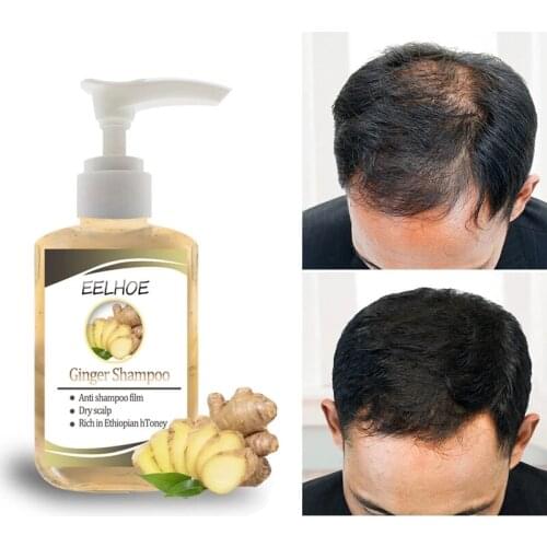 F'eDoren Hair Care Products