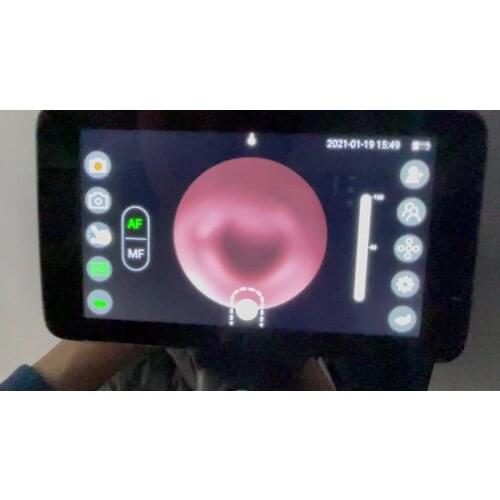 ENT diagnostic machine veterinary retinal fundus camera endoscopic camera for pet dog cat veterinary surgery use auto eye camera