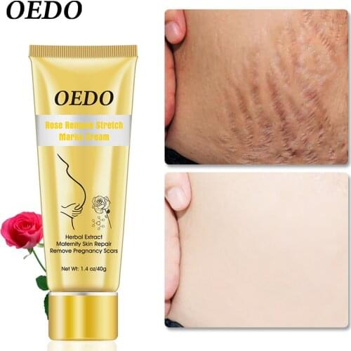 Rose Removes Stretch Mark Cream To Remove Postpartum Obesity Pregnant Women Repair Anti-Aging Anti-Winkles Firming Body Cream