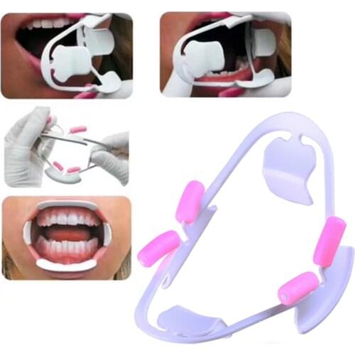 3D Oral Dental Mouth Opener Intraoral Cheek Lip Retractor Prop Orthodontic Tool Fit for Adult and Child 3D mouthpiece supporte