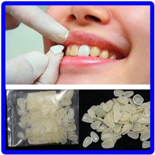 70pcs/lot Ultra-Thin Dental Temporary Crown Ultra Thin Resin Whitening Teeth Upper Anterior Shade Tooth Veneers Oral Care Tool