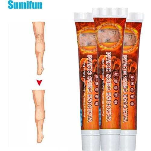 3PC Sumifun 2020 New Varicose Veins Treatment Ointment 100% Original Vasculitis Phlebitis Spider Pain Relief Cream Pain Plaster