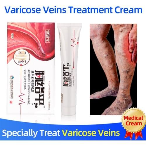 Varicose Veins Treatment Natural Herbal Medicine Cream Relieve Vein Pain Phlebitis Health Ointment