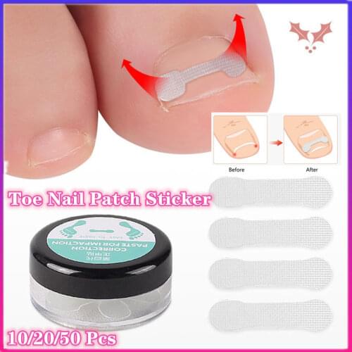 Toenail Ortho Nail Ingrown Nail Foot Care Correction Sticker Light Orthotic Portable Heavy Pedicure Tools ToeNail Patch Sticker