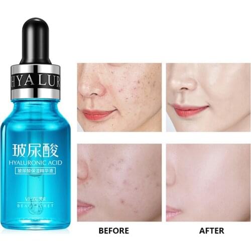 Hyaluronic Acid Moisturizing Essence Stock Solution Hyaluronic Acid is the Ideal Moisturizing Factor For Beauty And Moisturizing