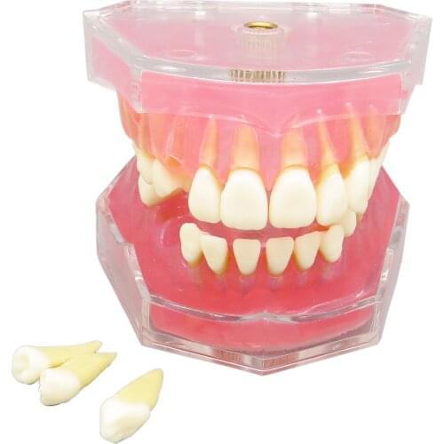 Dental Model Standard Model with Removable Teeth M4004