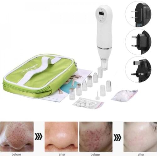 Peel Diamond Pro Microdermabrasion Vacuum Machine Dermabrasion Skin Facial Care