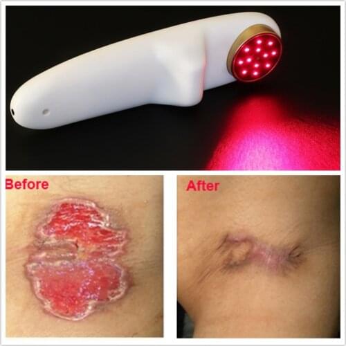 LLLT Cold Laser Medical Therapeutic Machine 650nm&808nm Red Light Therapy Pain Relief Wound Healing Laser Therapeutic Device