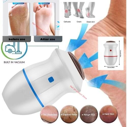 Foot New Electric Vacuum Foot Grinder File Machine Exfoliate Dead Skin Callus Remover Heel Removal Scraper Vacuums Grinding Head