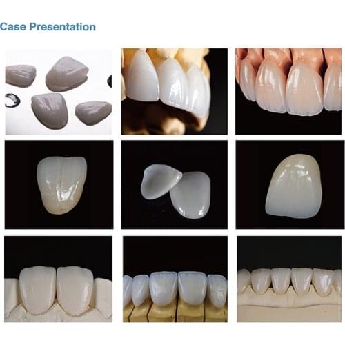 Yucera High Translucent Dental Lithium Dislicate Blocks Emax Glass Ceramic Block for Dental Lithium Dislicate C14-HT 5Piece