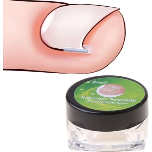 10pcs/set Ingrown Toenail Correcting Tool Pain Care Ingrowing Nail Corrector Used for Home
