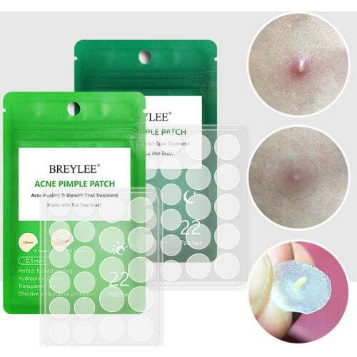 24 pcs Acne Pimple Patch Stickers Acne Treatment Pimple Remover Tool Blemish Spot Facial Mask Skin Care