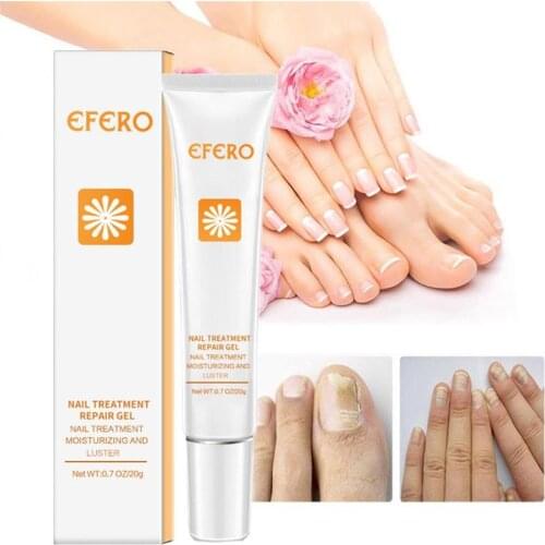 Nail Care Cream for Cracking Roughening Discoloration Brittleness Nail Fungal Treatment Feet Care Essence Nail Foot Nail Care