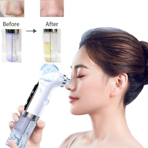 Electric Blackhead Remover Pore Vacuum Suction Facial Cleaner Rechargeable Water Cycle Pimple Removal Acne Extractor Tool