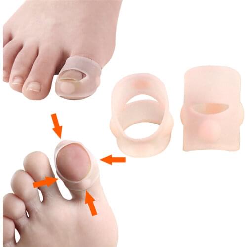 2Pcs Silicone Invisible Ingrown Toe Nail Treatment Ingrown Toenail Correction Tool Elastic Straightening Clip Brace