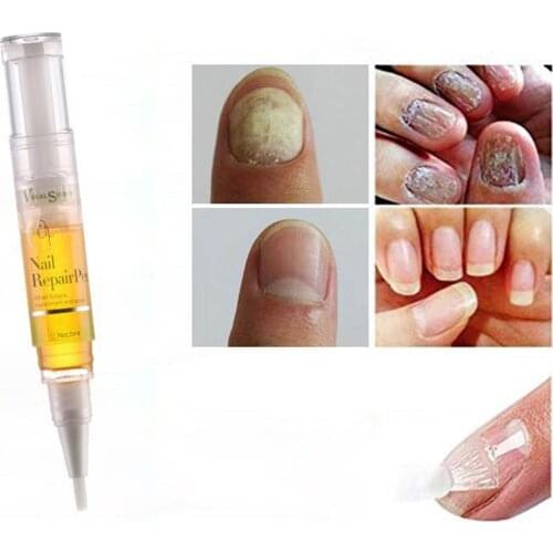 1PC Anti-champignon Traitement Des Ongles Doigt Soin Des Ongles Traitement Des
