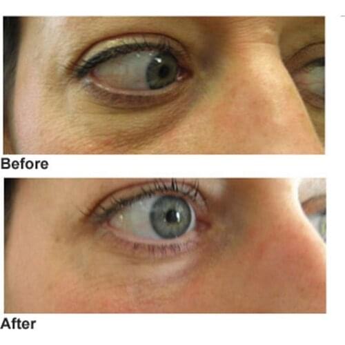 1KG Beauty Salon Equipment Quality Full Effect Wrinkle Eye Cream Moisturizing Anti-wrinkle 1000g Anti-Aging Products OEM