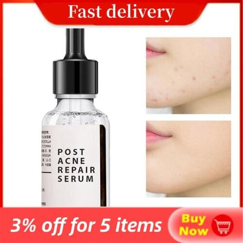 30ml Salicylic Acid 2% Solution Removes Acne Face serum Shrinks Pore Moisturizing Essence Fade Spot Brighten Face Skin Care