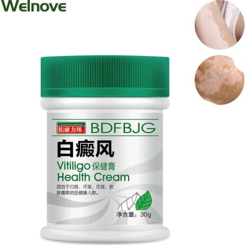 30g VitiligoTreament Cream Antibacterial Cream Psoriasis Localized Vitiligo Ointment White Spot Mycosis Leukoplakia Treat Cream