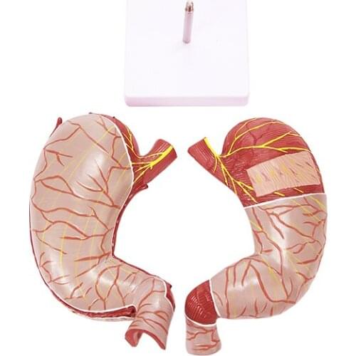 1.5X enlarged stomach anatomical structure model
