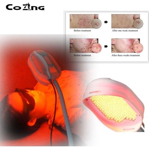 Blue Red LED Light Therapy Skin Rejuvenation PDT Anti-aging Facial Beauty Machine