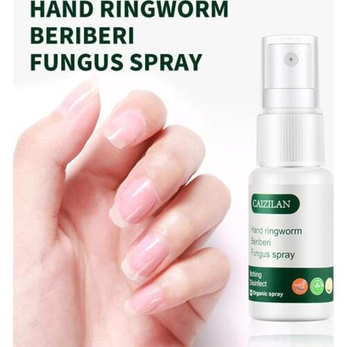 20ml Foot Anti Fungus Essence Serum Remove Onychomycosis Solution Health Care Liquid Liquid Repair Nail Repair Treatment O2O6