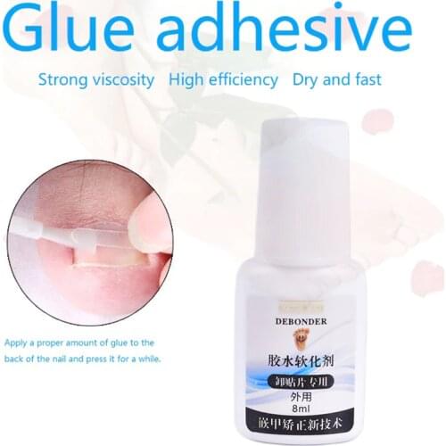 8ml Nail Correction Glue Paronychia Nail Glue Ingrown Toenail Correction Pedicure Toe Patch Foot Care Nail Art & Tools