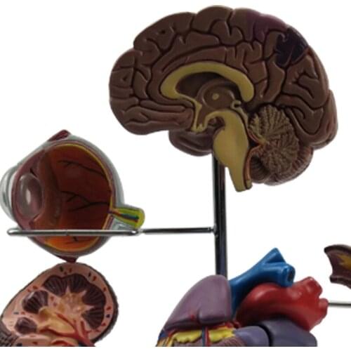 Diabetes model factory customized medical textbook diabetes model