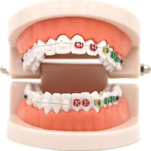 1pc Dental Orthodontic Treatment Model With Ortho Metal Ceramic Bracket Arch Wire Buccal Tube Ligature Ties Dental Tools