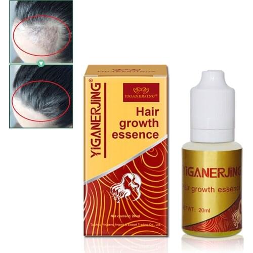 20ml Ginger Extract Dense Hair Fast Sunburst Hair Growth Essence Restoration Hair Loss Liquid Serum Hair Care Oil Care