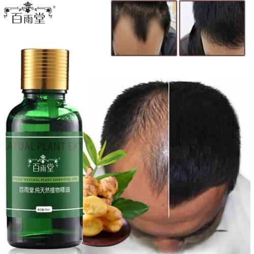 Hair Care Hair Growth Products Essential Oils Natural Effects Grow Hair Loss Essence Health Care Liquid Original Authentic 100