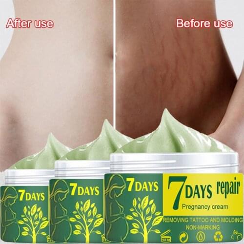 Body Cream Removal Pregnancy Scars Maternity Repairing Treatment Stretch Marks lotion Moisturizing Firming Skin Care Cream