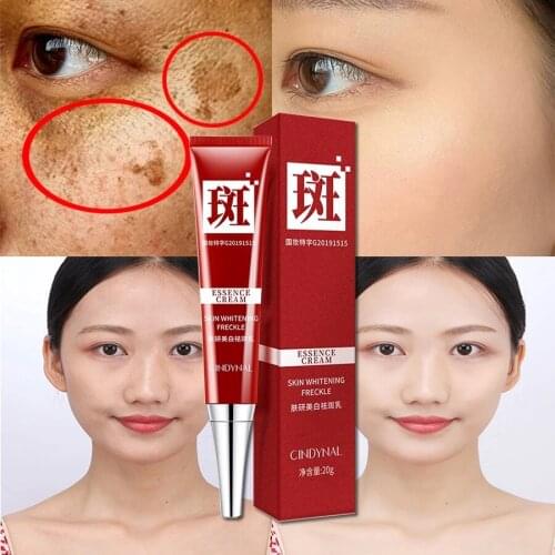 Whitening Freckle Cream Remove Melasma Cream Remove Dark Spots Melanin Melasma Remover Brighten Skin Anti-Aging Skin Lightening