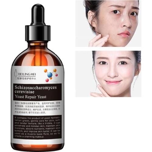 Nourish Face Serum Yeast Ampoule Essence Water Moisturizing Brighten Facial Mild Firm Repair Acne Marks Shrink Pores Skin Care P