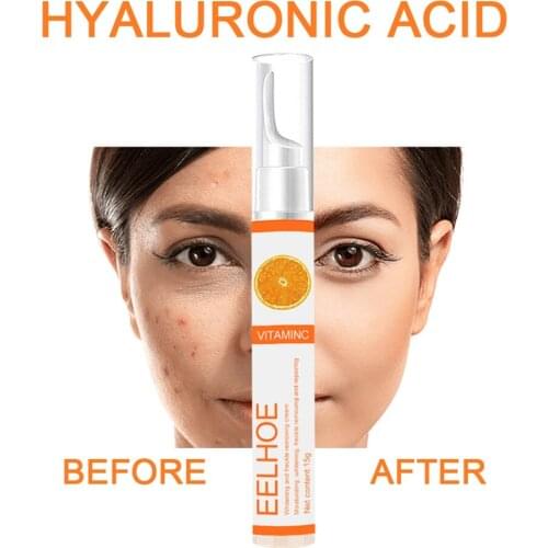 15g Vitamin C Freckle Remover Cream Remover Cream Skin Whitening Gel Reduces Pigmentation Hyaluronic Ideal Skin Treatment Cream