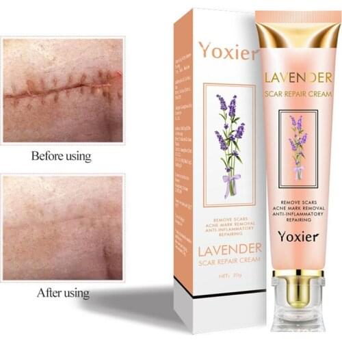 Lavender Repair Scar Cream Acne Scar Stretch Marks Skin Care Pigmentation Corrector Anti-allergic Calm Whitening Face Cream 20g