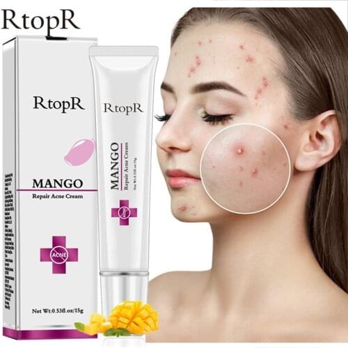 RtopR Acne Scar Cream Oil-Control Shrink Pores Blackhead Repair Whitening Cream Moisturizing Smoothing Gel Korean Cosmetics 15g