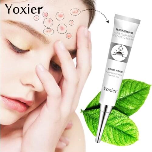 Yoxier Acne Treatment Face Cream Anti Acne Scar Removal Pimple Blackhead Moisturizing Whiten Oil-control Shrink Pores Skin Care