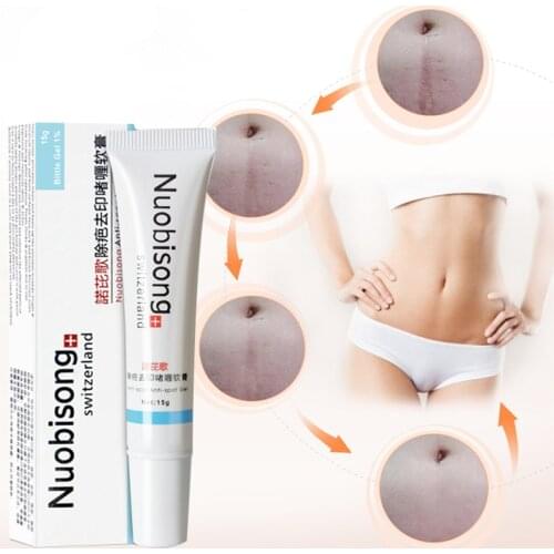 Nuobisong face skin care treatment face Pimples scar Stretch Marks removal acne treatment whitening moisturizing cream