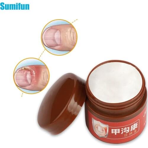 20g Nail Fungus Removal Cream Onychomycosis Fungal Nail Treatment Paronychia Anti Infection Feet Toe Fungal Nail Care Ointment