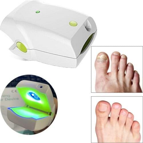 Personal healthcare use laser nail fungus laser device for nails 905nm laser Ringworm Onychomycosis treatment instrument